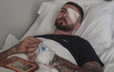 “SHQIPËRIA ËSHTË E JONA”/ U godit në sy me plumb gome, mesazhi i Erion Vishkullit nga shtrati i spitalit: Isha 30 m larg kur më qëlluan. Kam shumë dhimbje